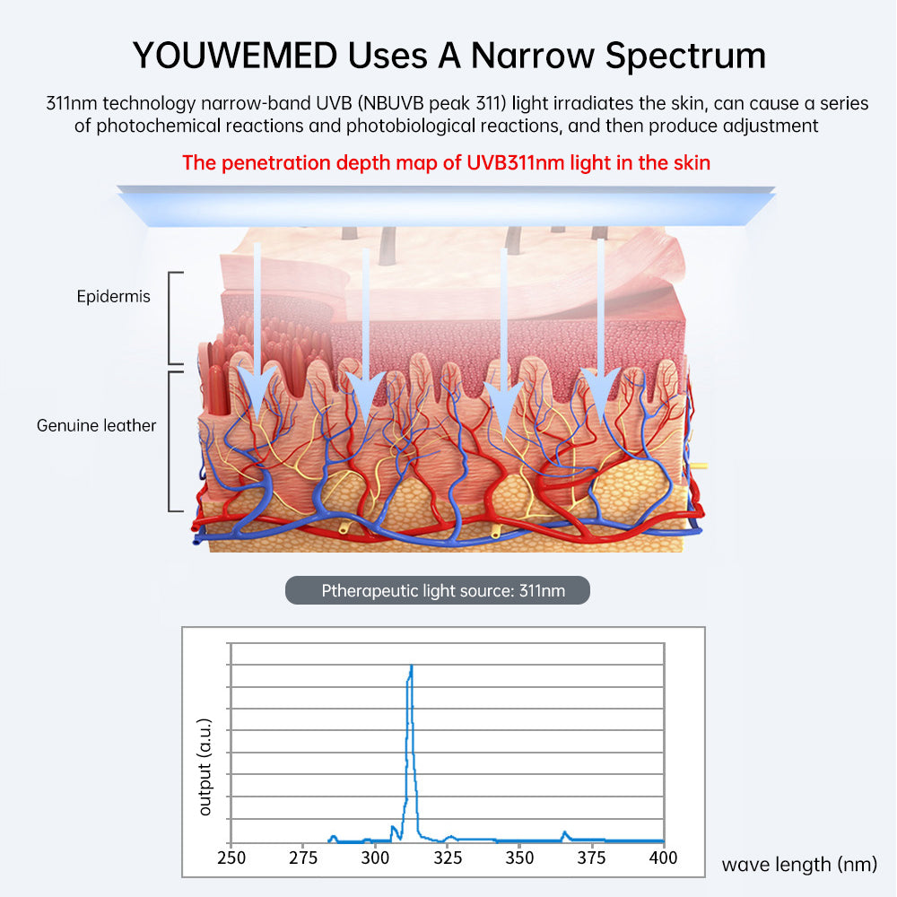 Struggling With Psoriasis, Eczema or Vitiligo? Discover How 308nm UVB Light Therapy May Help