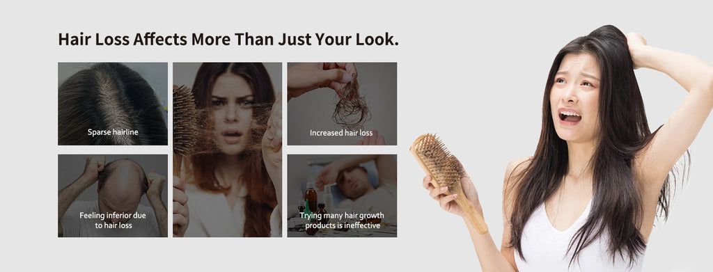 Say Goodbye to Hair Loss: How the 650nm Laser Regrowth Helmet Changes the Game