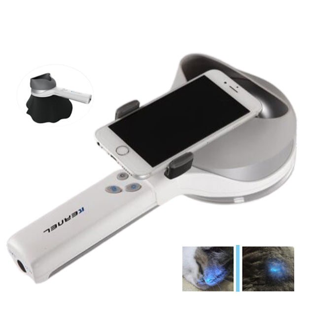 Portable Dermatology Wood’s Lamp UV Light Dermatoscope Skin Analyzer w