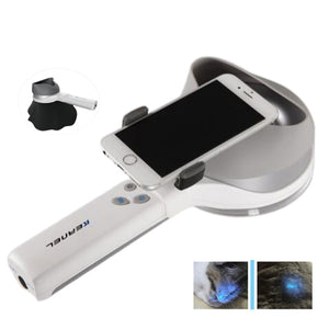 Portable Dermatology Wood’s Lamp UV Light Dermatoscope Skin Analyzer with Phone Holder – Vitiligo, Psoriasis, Eczema Observation Magnifier