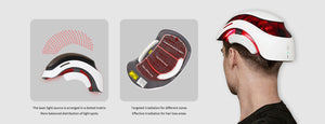 650nm Laser Hair Growth Helmet, 88 Medical-Grade Diodes for Hair Regrowth