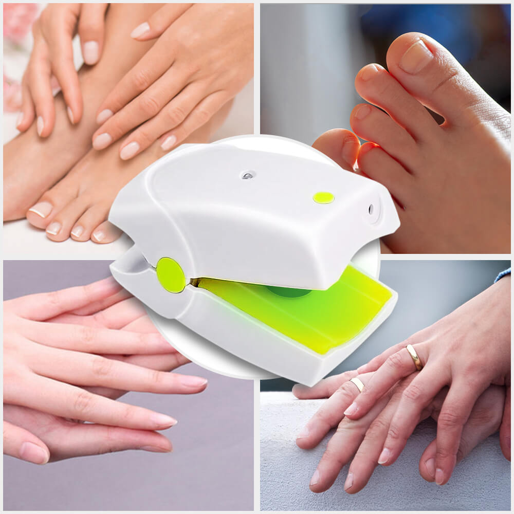 Laser Nail Fungus Therapy At Home | Best Way To Get Rid of Toe Fungus