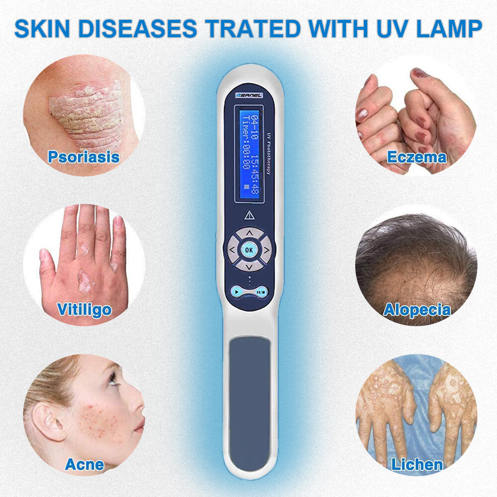 UV Light Disinfection Phototherapy Lamp for Psoriasis – HomeCareWholesale