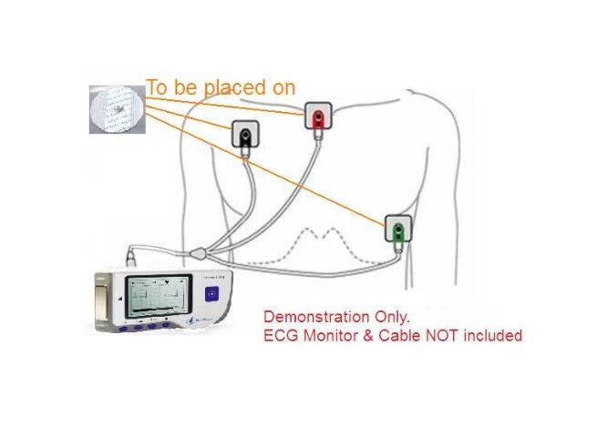 Disposable ECG Electrodes | Medical Electrodes | Electrode Pads